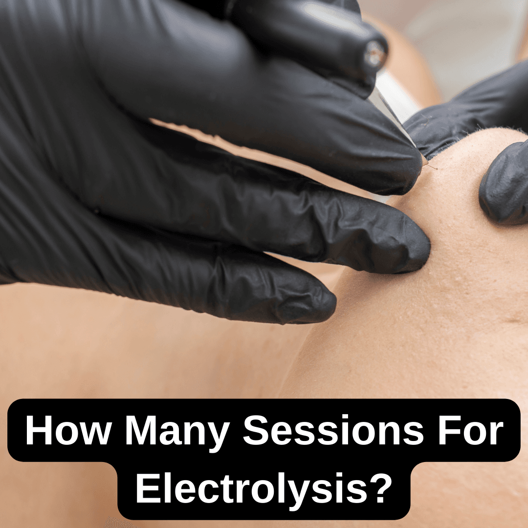 Electrolysis hair removal sessions – How many treatments are needed for permanent results?
